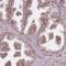 Transmembrane Channel Like 6 antibody, HPA051430, Atlas Antibodies, Immunohistochemistry paraffin image 