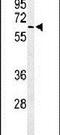 ALG10 Alpha-1,2-Glucosyltransferase antibody, PA5-26960, Invitrogen Antibodies, Western Blot image 