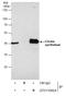 Citrate Synthase antibody, GTX110624, GeneTex, Immunoprecipitation image 