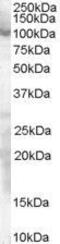 Sp1 Transcription Factor antibody, GTX89511, GeneTex, Western Blot image 