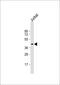 Pim-1 Proto-Oncogene, Serine/Threonine Kinase antibody, 63-293, ProSci, Western Blot image 