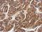 Ectodysplasin A Receptor antibody, LS-C311671, Lifespan Biosciences, Immunohistochemistry frozen image 