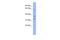 Kelch Like Family Member 40 antibody, A10541, Boster Biological Technology, Western Blot image 