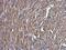 ME1 antibody, LS-C155292, Lifespan Biosciences, Immunohistochemistry frozen image 