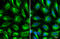 Acyl-CoA Synthetase Long Chain Family Member 4 antibody, GTX100260, GeneTex, Immunofluorescence image 