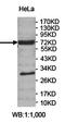 Zinc Finger Protein 658 antibody, orb78286, Biorbyt, Western Blot image 