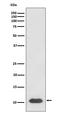 C-X-C Motif Chemokine Ligand 12 antibody, M00053, Boster Biological Technology, Western Blot image 