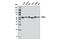 DEAD-Box Helicase 5 antibody, 9877S, Cell Signaling Technology, Western Blot image 