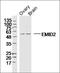 Collagen Type XXVI Alpha 1 Chain antibody, orb183384, Biorbyt, Western Blot image 