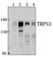 Transcriptional Repressor GATA Binding 1 antibody, PA5-75968, Invitrogen Antibodies, Western Blot image 