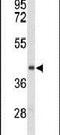 Ectonucleoside Triphosphate Diphosphohydrolase 2 antibody, PA5-26333, Invitrogen Antibodies, Western Blot image 