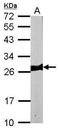 Myosin Light Chain 3 antibody, GTX102930, GeneTex, Western Blot image 