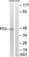p53 antibody, TA326087, Origene, Western Blot image 