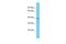 Ankyrin Repeat Domain 16 antibody, PA5-70920, Invitrogen Antibodies, Western Blot image 