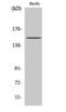 AT-Rich Interaction Domain 4B antibody, STJ91886, St John