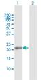 RAB13, Member RAS Oncogene Family antibody, H00005872-D01P, Novus Biologicals, Western Blot image 