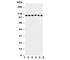 Matrilin 2 antibody, R31026, NSJ Bioreagents, Western Blot image 