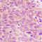 PDZ Binding Kinase antibody, GTX54960, GeneTex, Immunohistochemistry paraffin image 