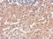 Alanyl-TRNA Synthetase antibody, NBP1-31706, Novus Biologicals, Immunohistochemistry paraffin image 