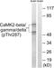 Calcium/Calmodulin Dependent Protein Kinase II Beta antibody, abx012596, Abbexa, Western Blot image 