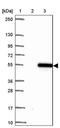 Thyroid Hormone Receptor Interactor 13 antibody, PA5-62728, Invitrogen Antibodies, Western Blot image 