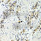 Wnt Family Member 3A antibody, A0642, ABclonal Technology, Immunohistochemistry paraffin image 