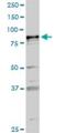 Phospholipase A2 Group VI antibody, H00008398-D01P, Novus Biologicals, Western Blot image 