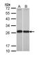 Glutathione S-Transferase Pi 1 antibody, NBP2-16757, Novus Biologicals, Western Blot image 