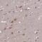 Tubulin Folding Cofactor B antibody, NBP1-85672, Novus Biologicals, Immunohistochemistry paraffin image 