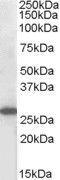 Suppressor Of Cytokine Signaling 3 antibody, GTX89907, GeneTex, Western Blot image 