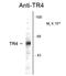 Nuclear Receptor Subfamily 2 Group C Member 2 antibody, GTX82576, GeneTex, Western Blot image 