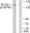 Phospholipase C Gamma 1 antibody, LS-C199475, Lifespan Biosciences, Western Blot image 