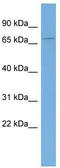KH Domain Containing 4, Pre-MRNA Splicing Factor antibody, TA333861, Origene, Western Blot image 
