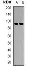 B-Raf Proto-Oncogene, Serine/Threonine Kinase antibody, LS-C368803, Lifespan Biosciences, Western Blot image 