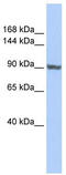 TNNI3 Interacting Kinase antibody, TA346506, Origene, Western Blot image 