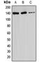 Ataxin 2 antibody, MBS821264, MyBioSource, Western Blot image 