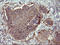 Matrix Metallopeptidase 13 antibody, LS-C788301, Lifespan Biosciences, Immunohistochemistry frozen image 