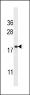 Transmembrane Protein 70 antibody, PA5-48494, Invitrogen Antibodies, Western Blot image 