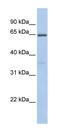 Cytochrome B-245 Beta Chain antibody, 25-944, ProSci, Western Blot image 