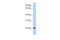 SSX Family Member 5 antibody, 25-521, ProSci, Western Blot image 