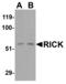 Receptor Interacting Serine/Threonine Kinase 2 antibody, 2183, QED Bioscience, Western Blot image 