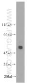 Serine/Threonine/Tyrosine Kinase 1 antibody, 18028-1-AP, Proteintech Group, Western Blot image 