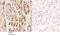 Chemerin Chemokine-Like Receptor 1 antibody, A02960-1, Boster Biological Technology, Immunohistochemistry paraffin image 