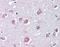 Gamma-Aminobutyric Acid Type A Receptor Beta3 Subunit antibody, orb88996, Biorbyt, Immunohistochemistry paraffin image 