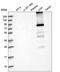 Glycogen Synthase 2 antibody, HPA039482, Atlas Antibodies, Western Blot image 