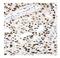 X-Ray Repair Cross Complementing 5 antibody, PA1641, Boster Biological Technology, Immunohistochemistry paraffin image 