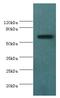 Anti-Mullerian Hormone Receptor Type 2 antibody, LS-C377389, Lifespan Biosciences, Western Blot image 