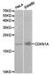 p21 antibody, TA327053, Origene, Western Blot image 
