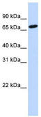 Histidine Ammonia-Lyase antibody, TA338257, Origene, Western Blot image 