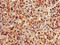 Chromobox 5 antibody, LS-C369373, Lifespan Biosciences, Immunohistochemistry paraffin image 